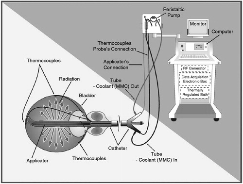 hyperthermie synergo systeem